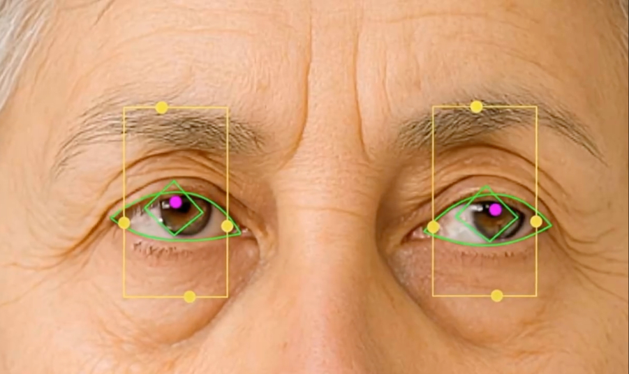 5-min gaze assessment on iPad